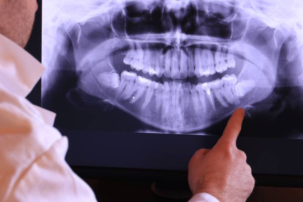 Best Emergency Treatment for Dental Infections or Abscesses in White House Station, NJ