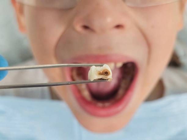 Best Weekend Emergency Dentist in White House Station, NJ
